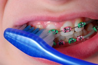 Braces Care - Orthodontics in South Plainfield, NJ